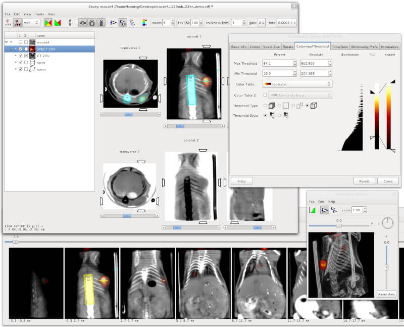 AMIDE - Examinateur de données d'imagerie médicale